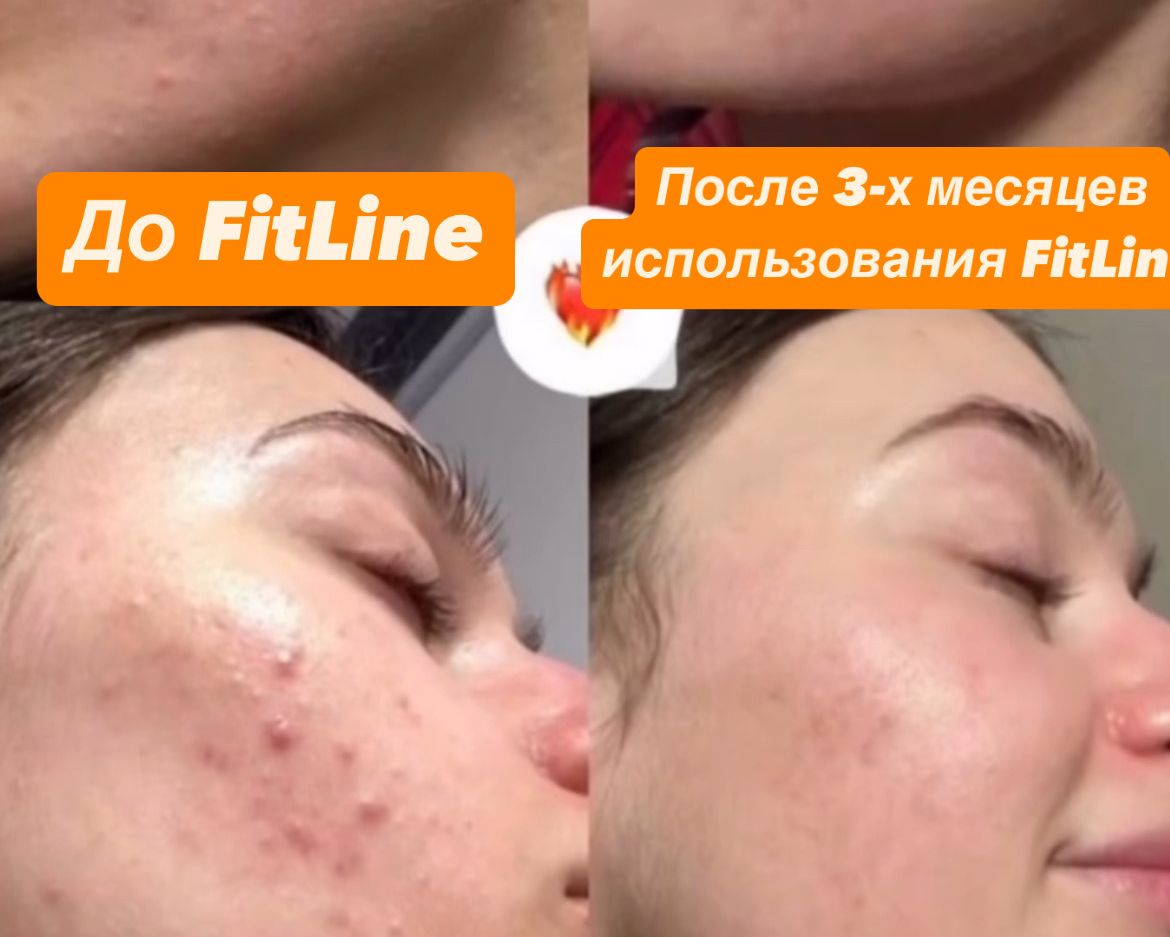 лечение фитлайн витамины бады похудеть с фитлайн разоблачение 