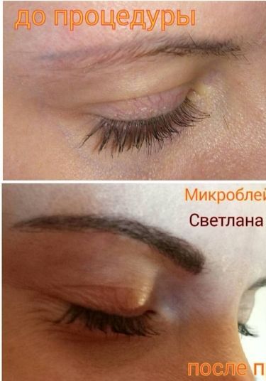 О&nbsp;микроблейдинге