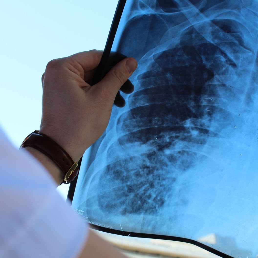 Купить Базовый курс по рентгенографии и КТ лёгких для терапевтовДОСТУПЕН В ЗАПИСИ!