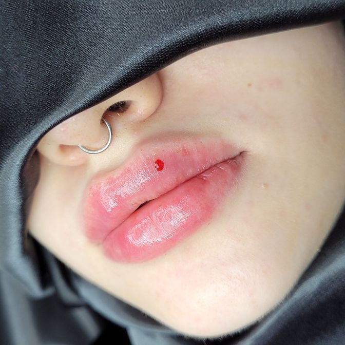 галерея