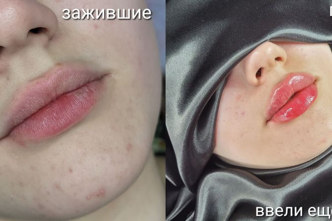 галерея